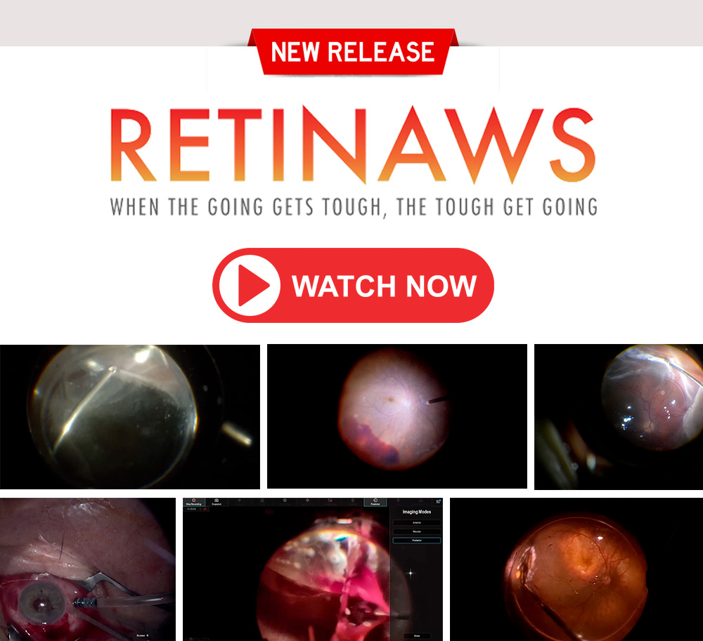 Retina Today tweet media