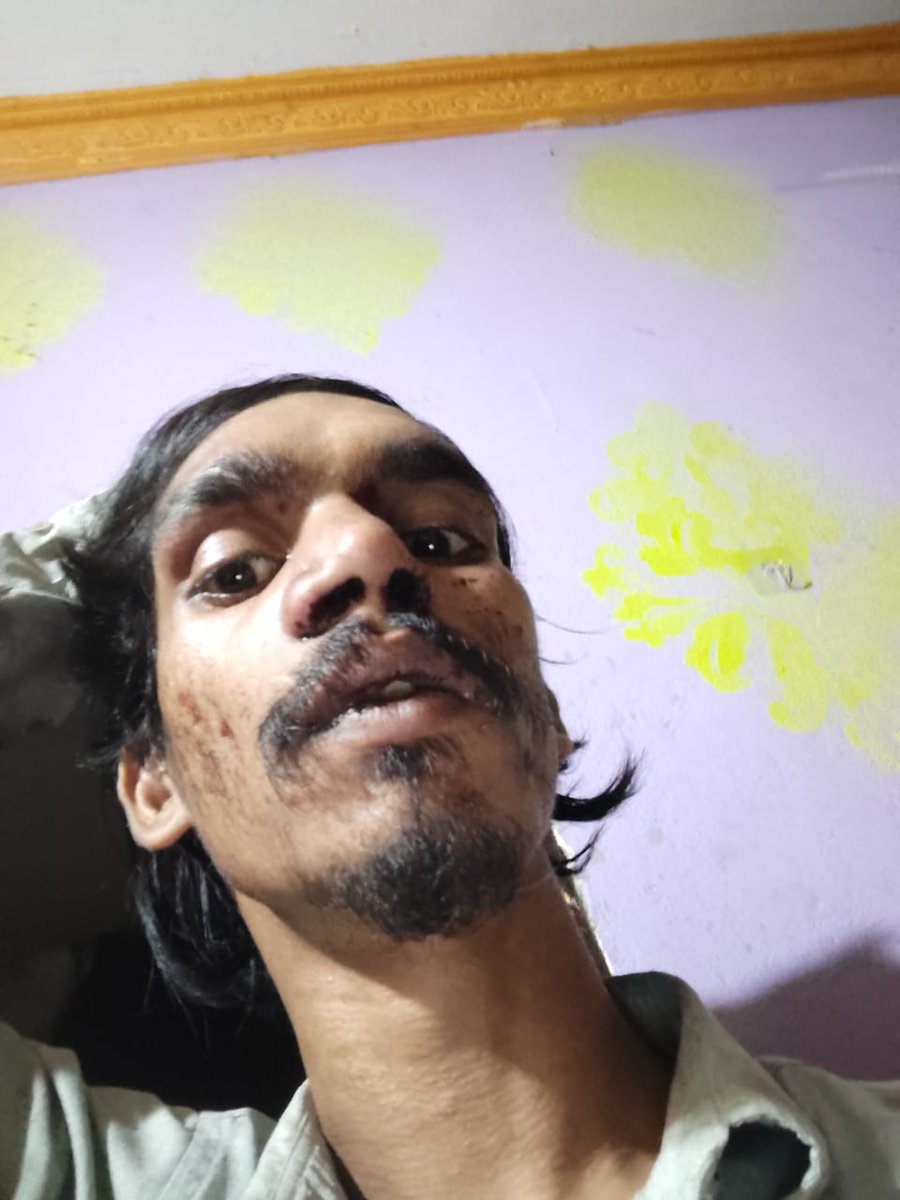 MohdZee08093480's tweet photo. @DCP_SWZ @CVAnandIPS @sholangerhouse @acpgolconda A serious assault was reportedly witnessed under Langer House Police Station limits in Hyderabad, where Sohail Anwar Shaik and two others were allegedly attacked by unidentified persons after a heated argument near their residence https://t.co/aBHgCQdB7t
