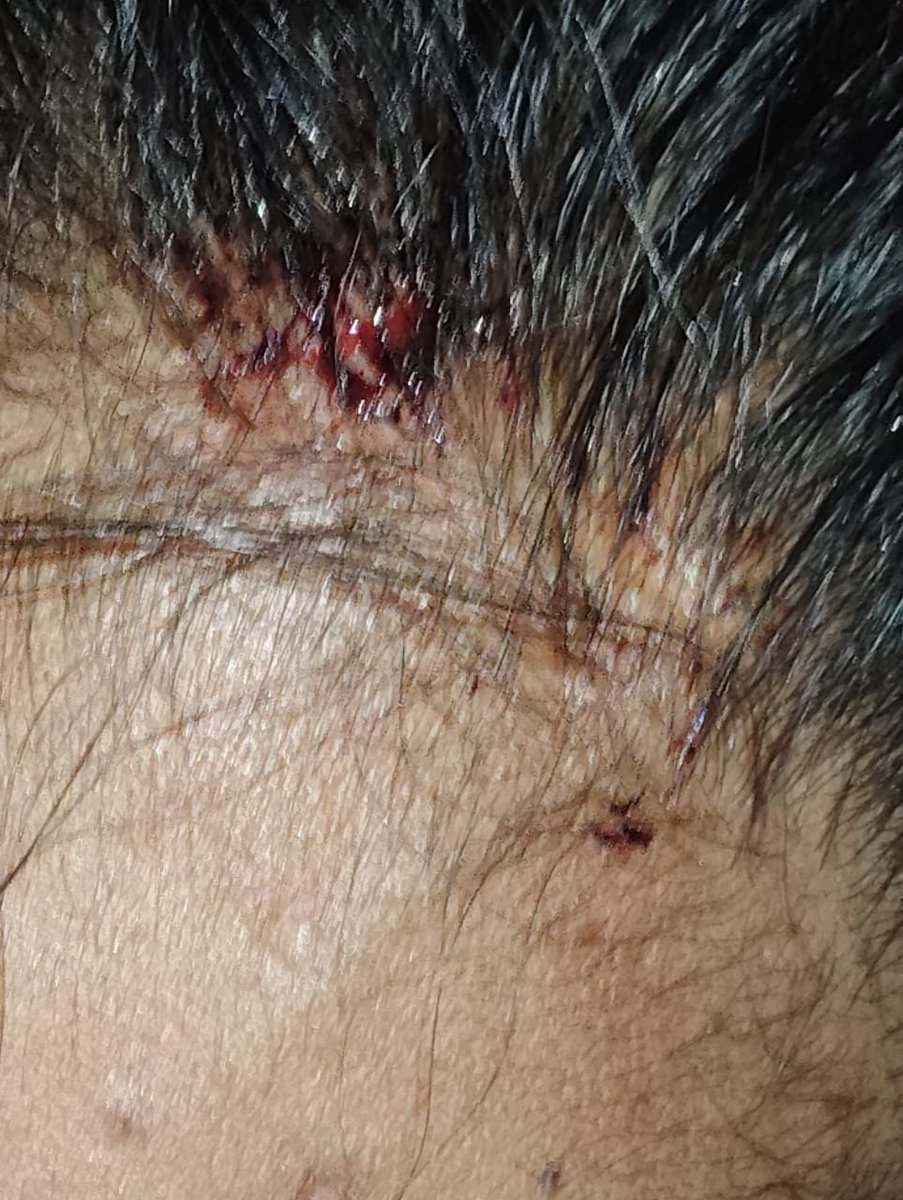 MohdZee08093480's tweet photo. @DCP_SWZ @CVAnandIPS @sholangerhouse @acpgolconda A serious assault was reportedly witnessed under Langer House Police Station limits in Hyderabad, where Sohail Anwar Shaik and two others were allegedly attacked by unidentified persons after a heated argument near their residence https://t.co/aBHgCQdB7t