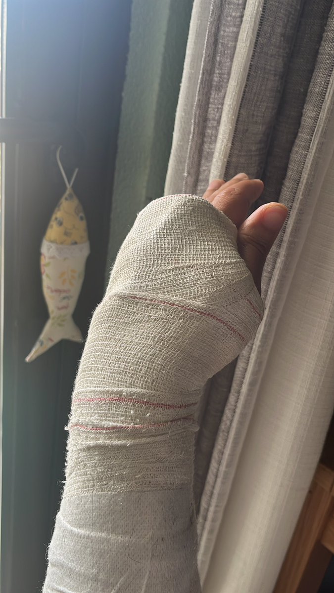 AnseC8's tweet photo. E depois de uma grande queda ah um mês a traz, amanhã vou à faca. vantagem?? Vou ter um  pulso quase novo. https://t.co/qEryiLVmi2