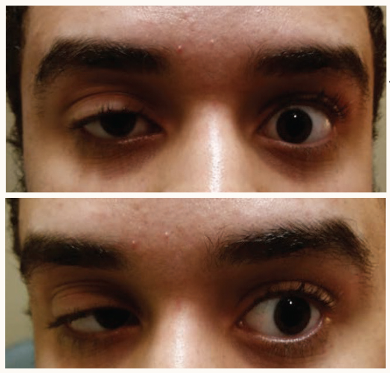 Review of Optometry tweet media