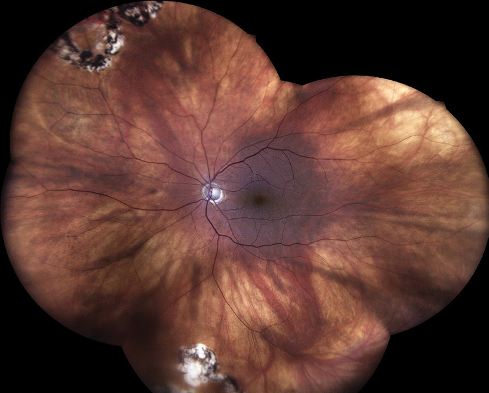 Review of Optometry tweet media