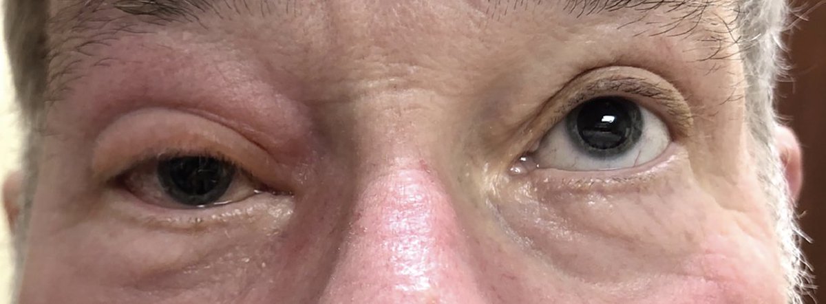 Review of Optometry tweet media