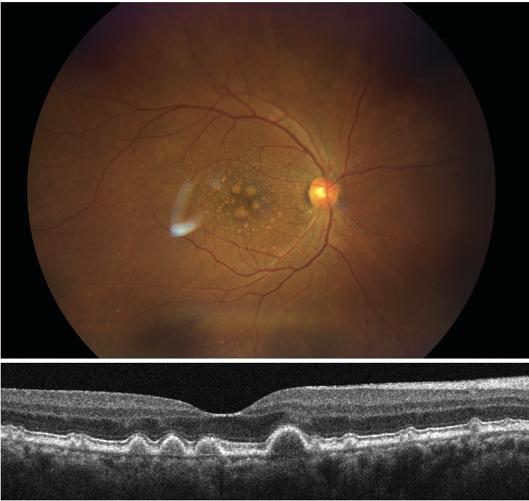 Review of Optometry tweet media