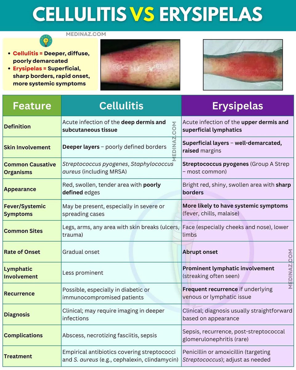 NY3080's tweet photo. @hemo_shk Erysipelas Vs cellulitis https://t.co/wkUu6OYAt1
