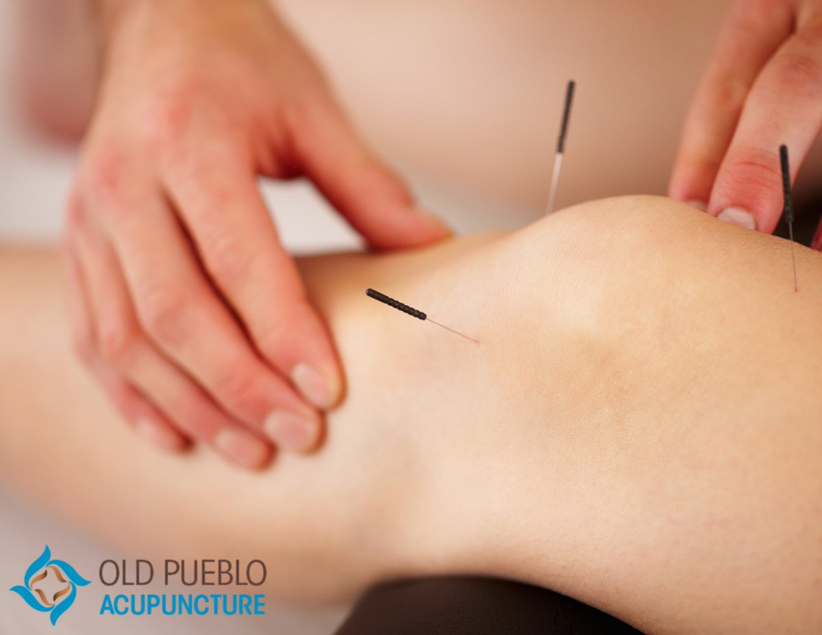 OPacupuncture1's tweet photo. 🌿 Looking for a natural approach to wellness? We provide professional #Acupuncture services focused on helping patients improve balance, wellness, and overall quality of life through personalized care plans. 

Learn more at https://t.co/lO3qtqtr8l #HolisticHealth https://t.co/fiN28TcTCD