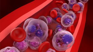 RobyChil's tweet photo. Scoperto un modo per dare nuova linfa alle #cellule #immunitarie indebolite nella #lotta contro il #mieloma #multiplo. In due studi pubblicati…
Continua a leggere qui: https://t.co/w0pIvi7hgv https://t.co/XHPilhVW9R