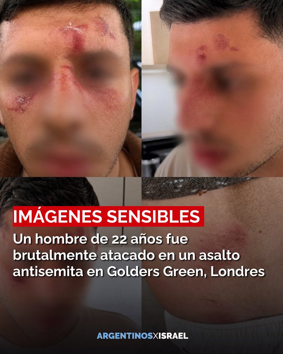 ArgxIsrael's tweet photo. Mientras un joven hablaba en hebreo en las calles de Londres, cinco hombres enmascarados lo persiguieron, lo arrastraron por la carretera, lo golpearon hasta casi dejarlo inconsciente, le arrancaron la ropa y gritaron insultos en árabe. https://t.co/MjtLIxLxV0