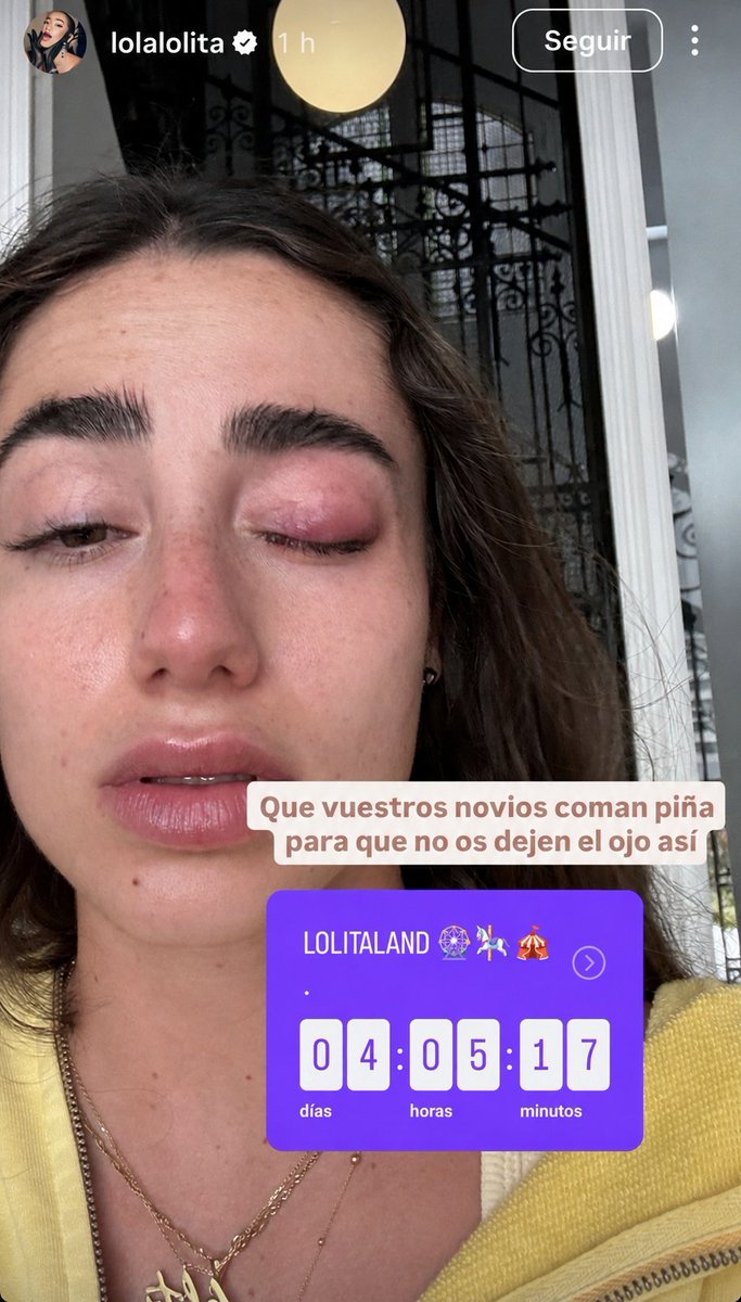 Pausismo tweet media