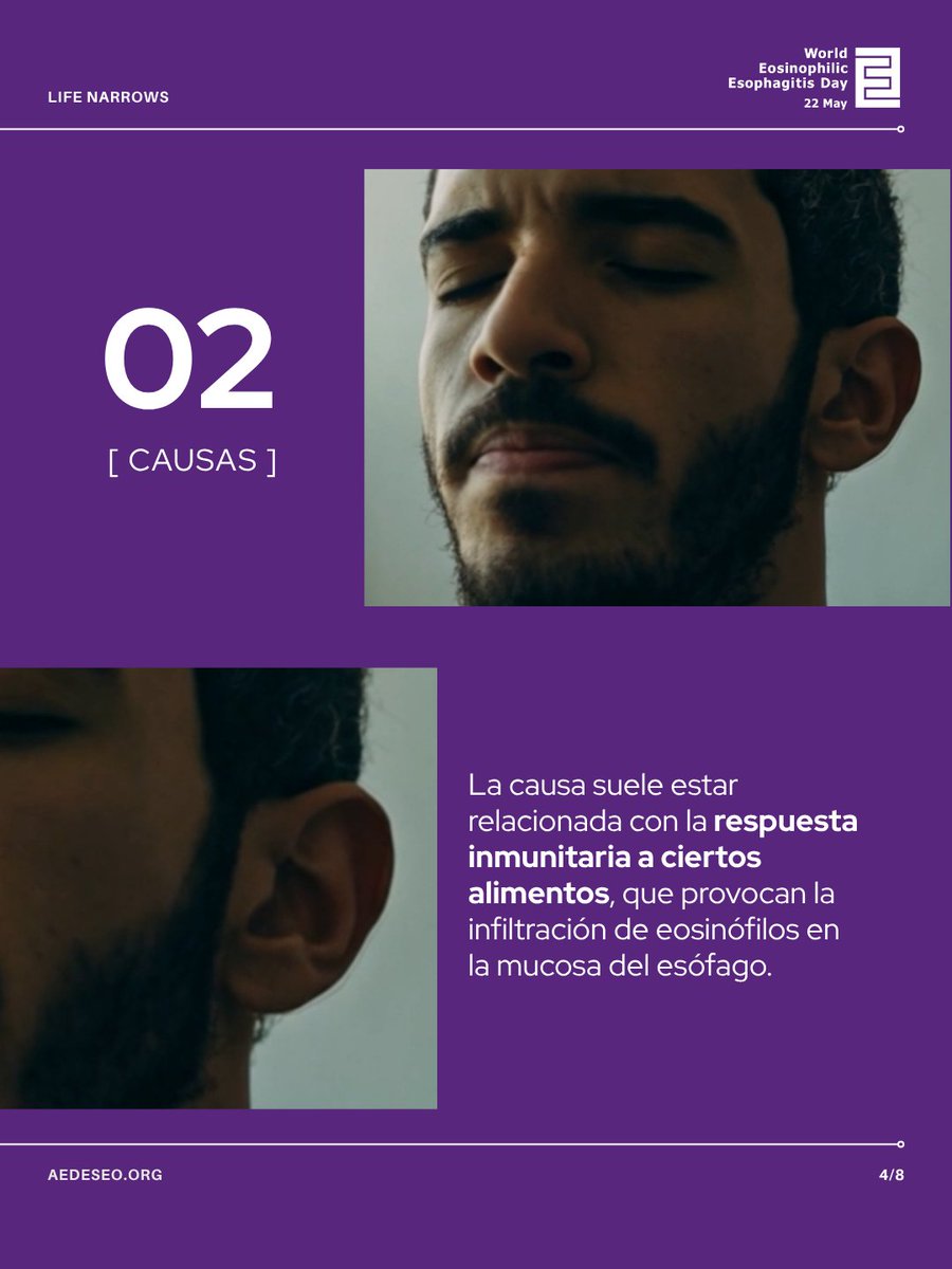 aedeseo's tweet photo. 🩷 Reconocer la EoE a tiempo puede cambiar una vida. Por eso, el papel de Atención Primaria es clave. Desde AEDESEO seguimos impulsando acciones para favorecer el diagnóstico precoz, como el reciente convenio firmado con la @SEMG_ES 💜 https://t.co/Z1lL5kx6p8