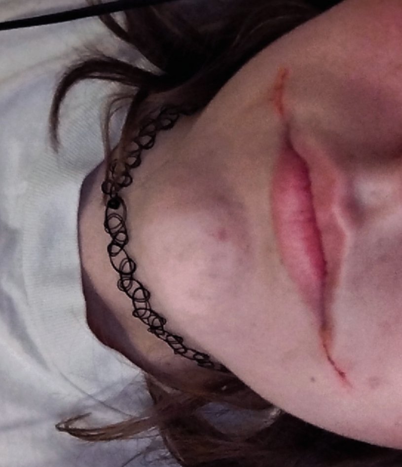 Misty_Rius's tweet photo. TS FAKE (hell nah) 
It's not the deepest, but found out that it's easier to cut there cuz it doesn't hurt that much. #shtwt #selfharm #selfharmtwt #makeup #sh https://t.co/g9dBs8MgrT