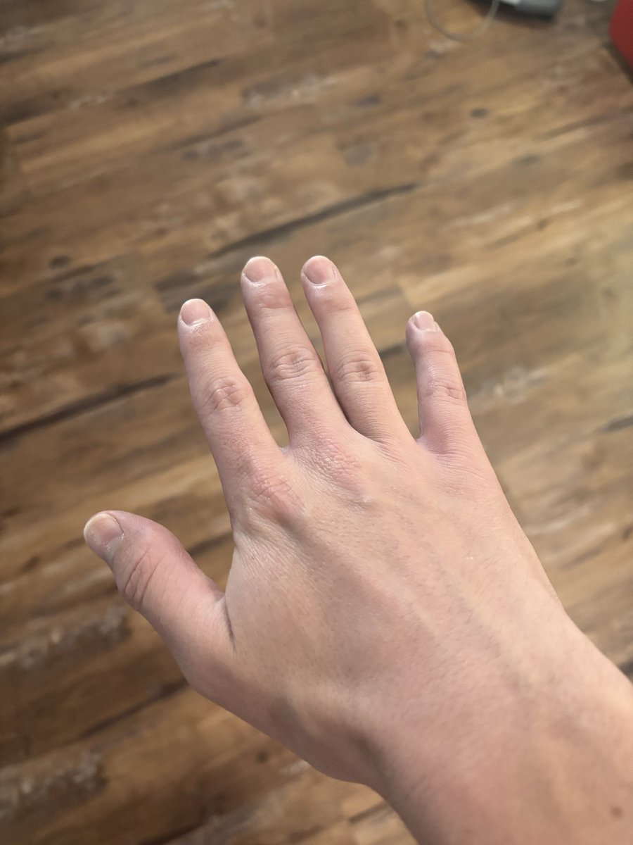 Vexy 🔻 tweet media