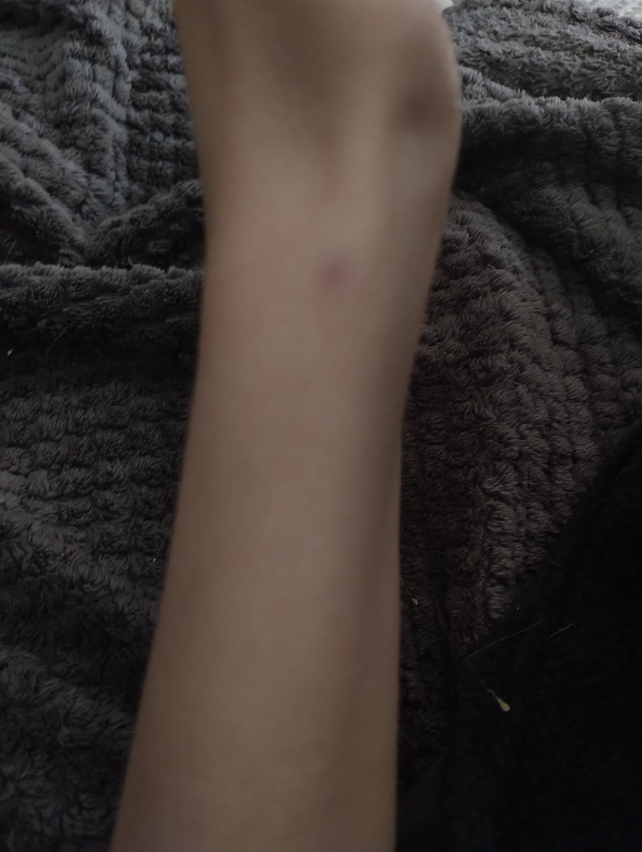 bboywithpaws's tweet photo. little bruise where did u comr from litttle bruise https://t.co/oc59sDJGUY