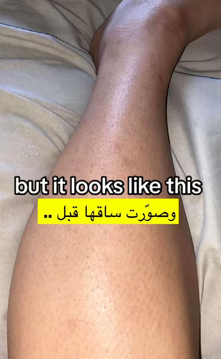 نوف 🌈 tweet media