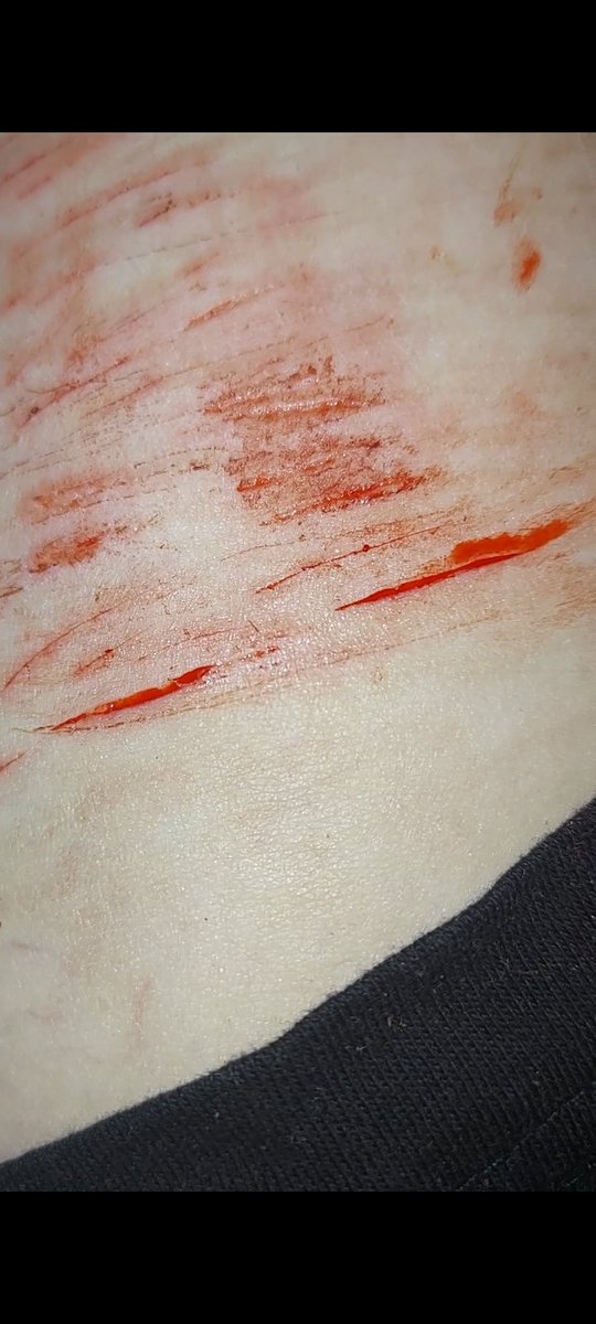 cut slut 🩸🔪 tweet media