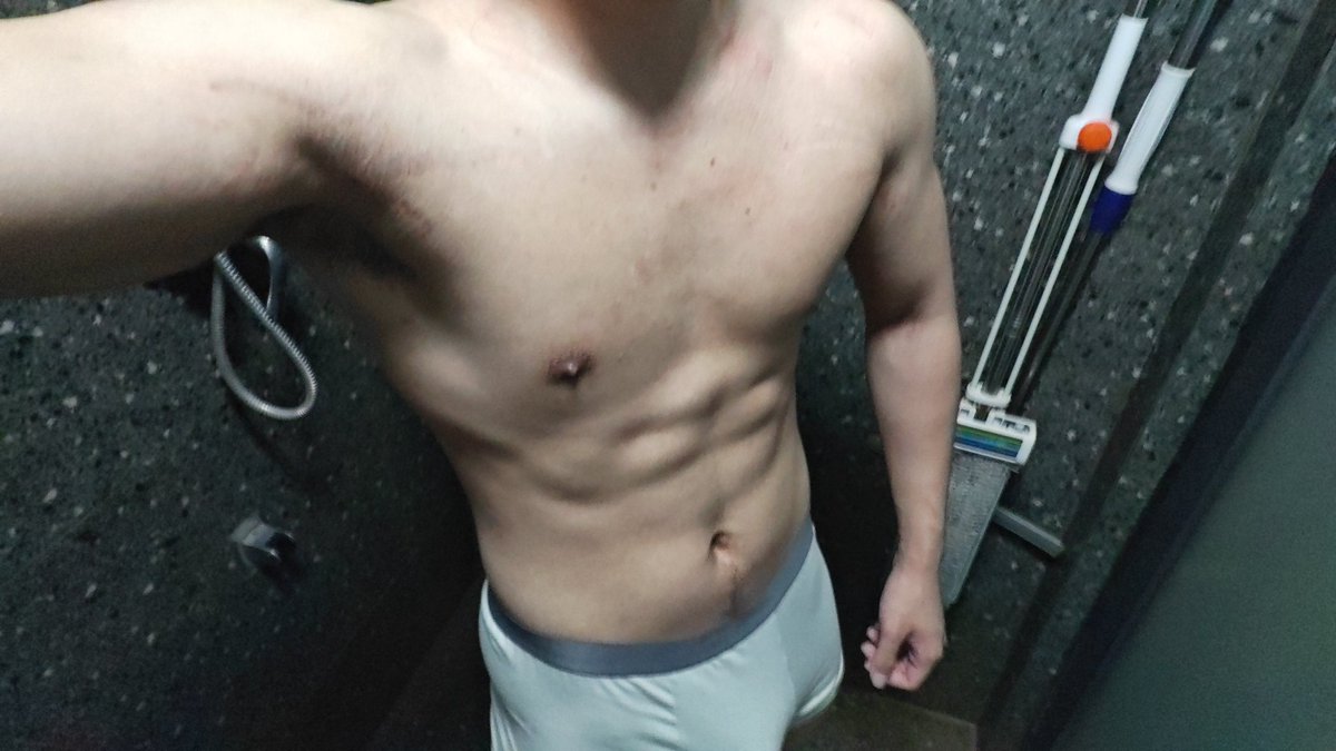 治好了也流口水🤤 tweet media