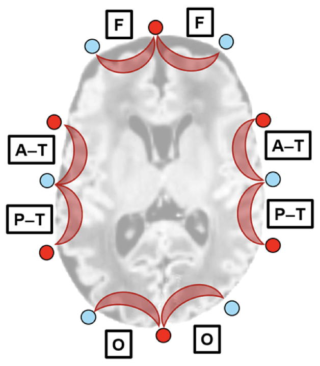 Imaging Neuroscience tweet media