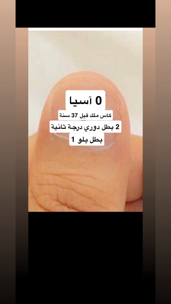 نخبتين في الرأس توجع tweet media