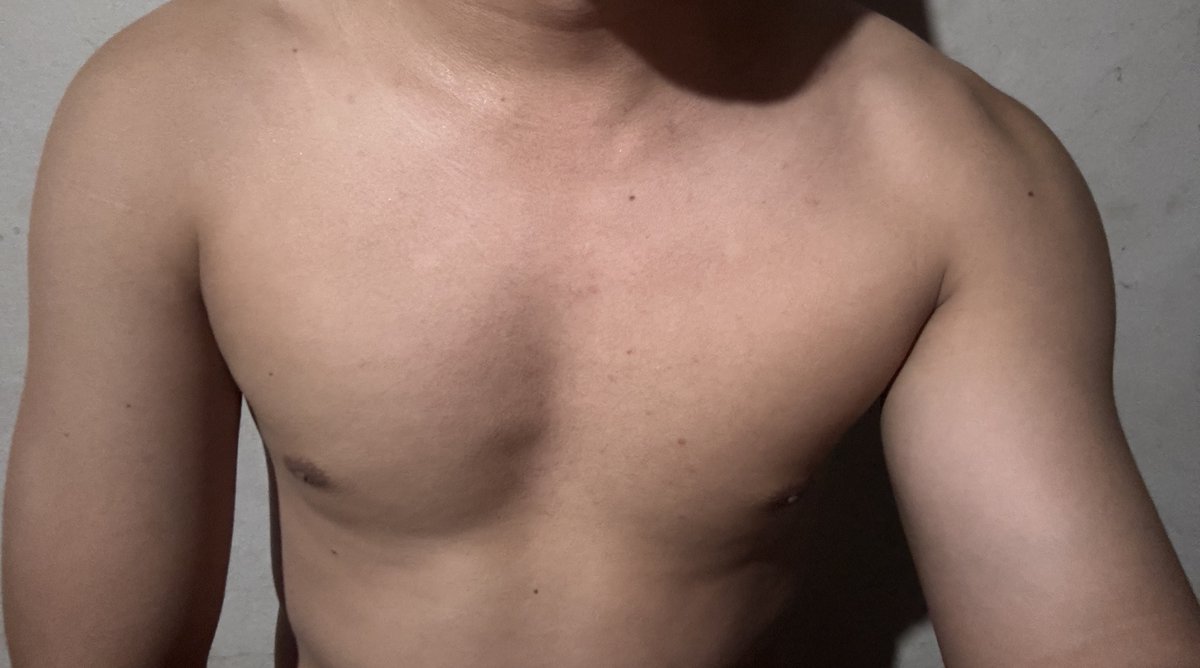 dm_jaccck's tweet photo. 🧐 https://t.co/Jt1x8F7n1G