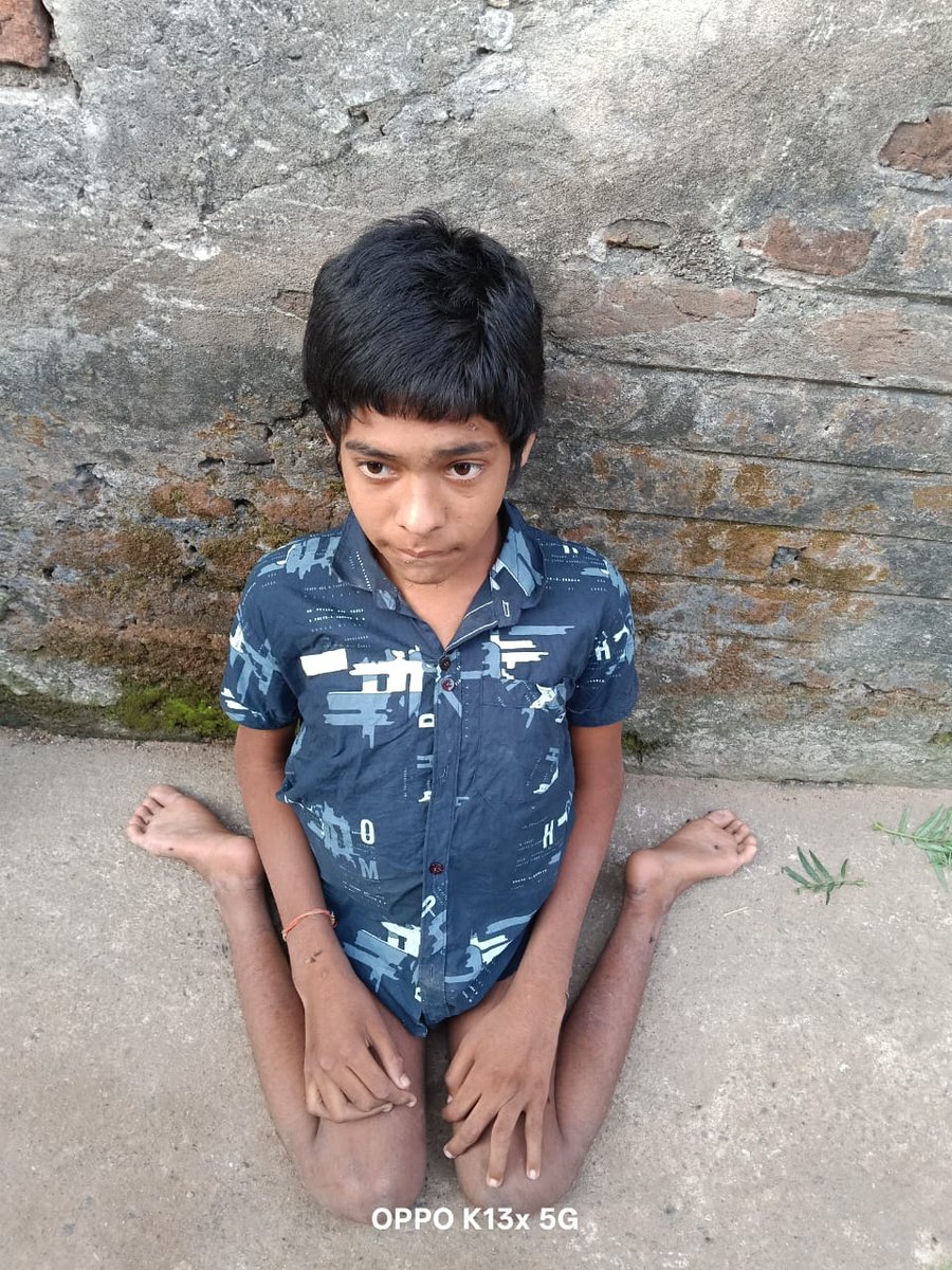 RameshMeher_'s tweet photo. ୮୦% ଭିନ୍ନକ୍ଷମ ଥିବାବେଳେ ୧୨୦୦/- ଟଙ୍କା ଭତ୍ତା ମିଳୁଛି। ତୁରନ୍ତ ୩୫୦୦/- ଭତ୍ତା ପ୍ରଦାନ କରାଯାଉ। @CMO_Odisha @dssosonepur1 @SSEPD2 @DM_Subarnapur 
ରୋହିତ୍ ମେହେର 
ପି: ପବିତ୍ର ମେହେର 
ରୁଗୁଡ଼ିପାଲି, ବ୍ରାହ୍ମଣୀ,ତରଭା, ସୁବର୍ଣ୍ଣପୁର https://t.co/tHoX461WRB