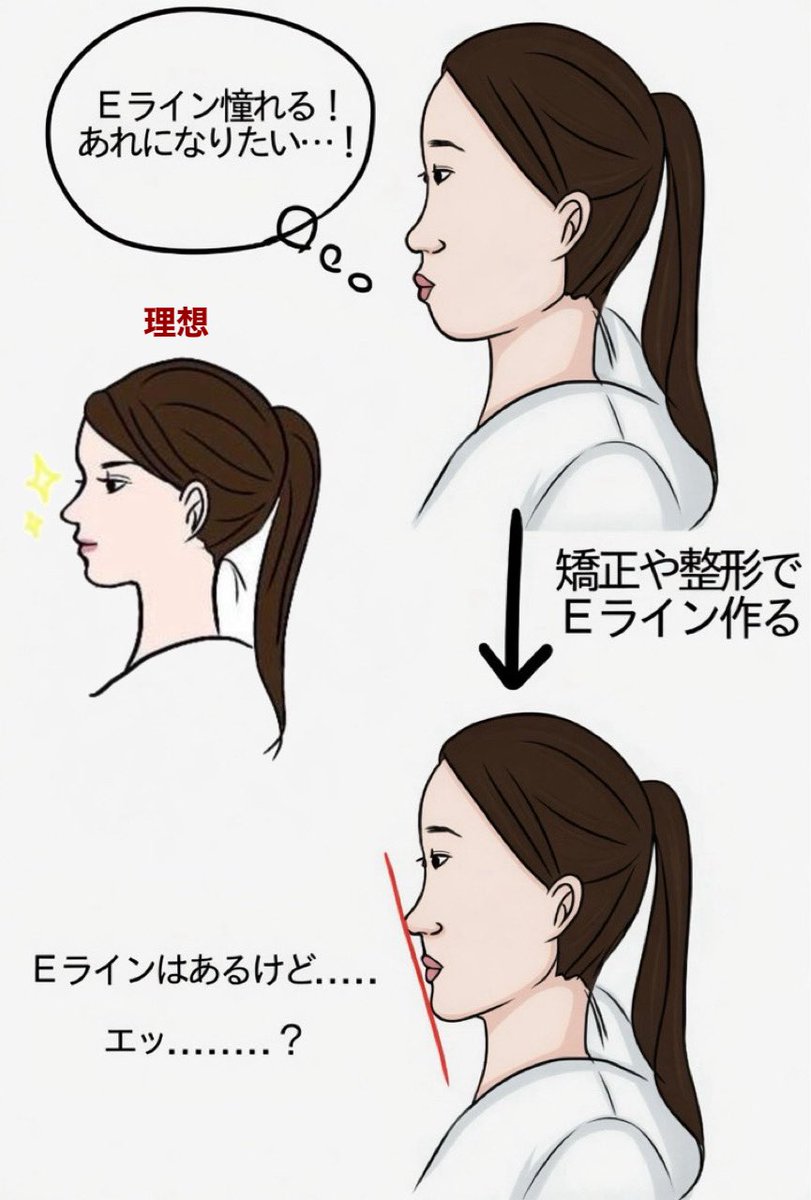輪郭3点良医選び🏥エラ削り、頬骨削り、両顎手術、顔脂肪吸引、鼻中隔延長、鼻尖形成、小鼻縮小、鼻整形 tweet media