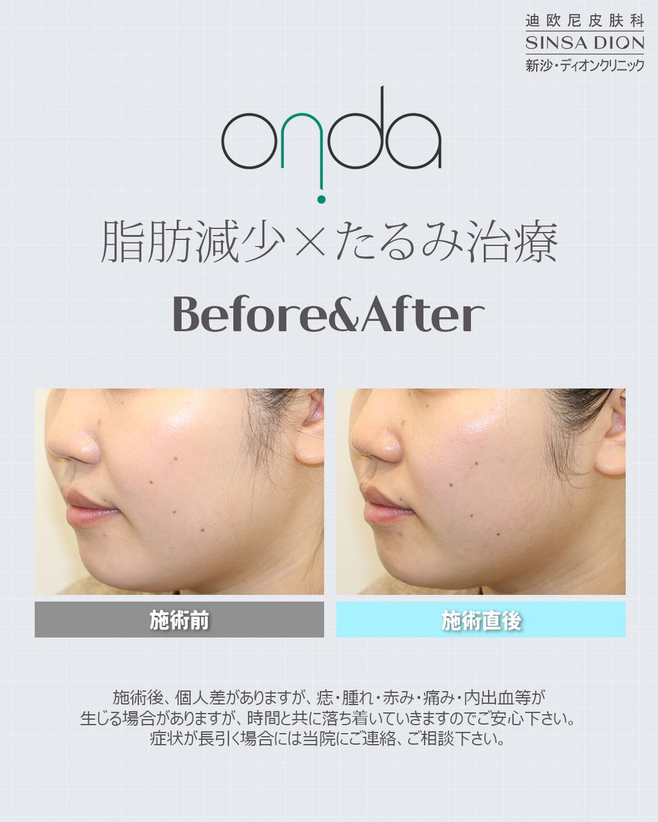 【韓国美容】新沙ディオンクリニック💆🏻♀️💖SINSA DION CLINIC tweet media