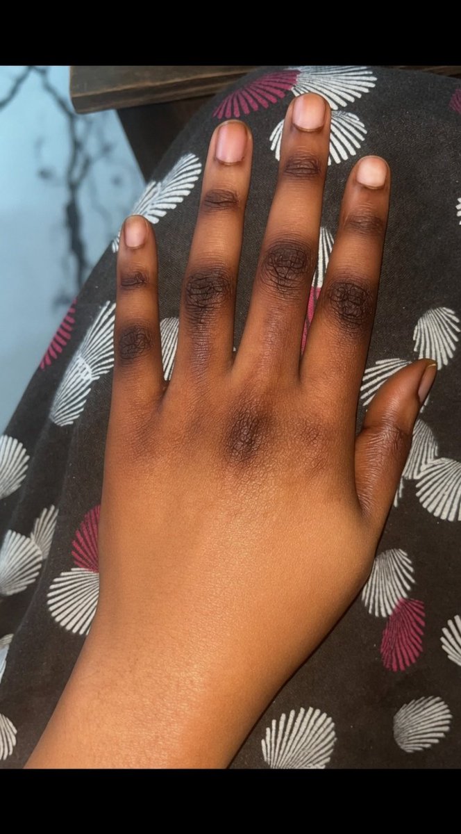 Nyaburi 🐝 tweet media