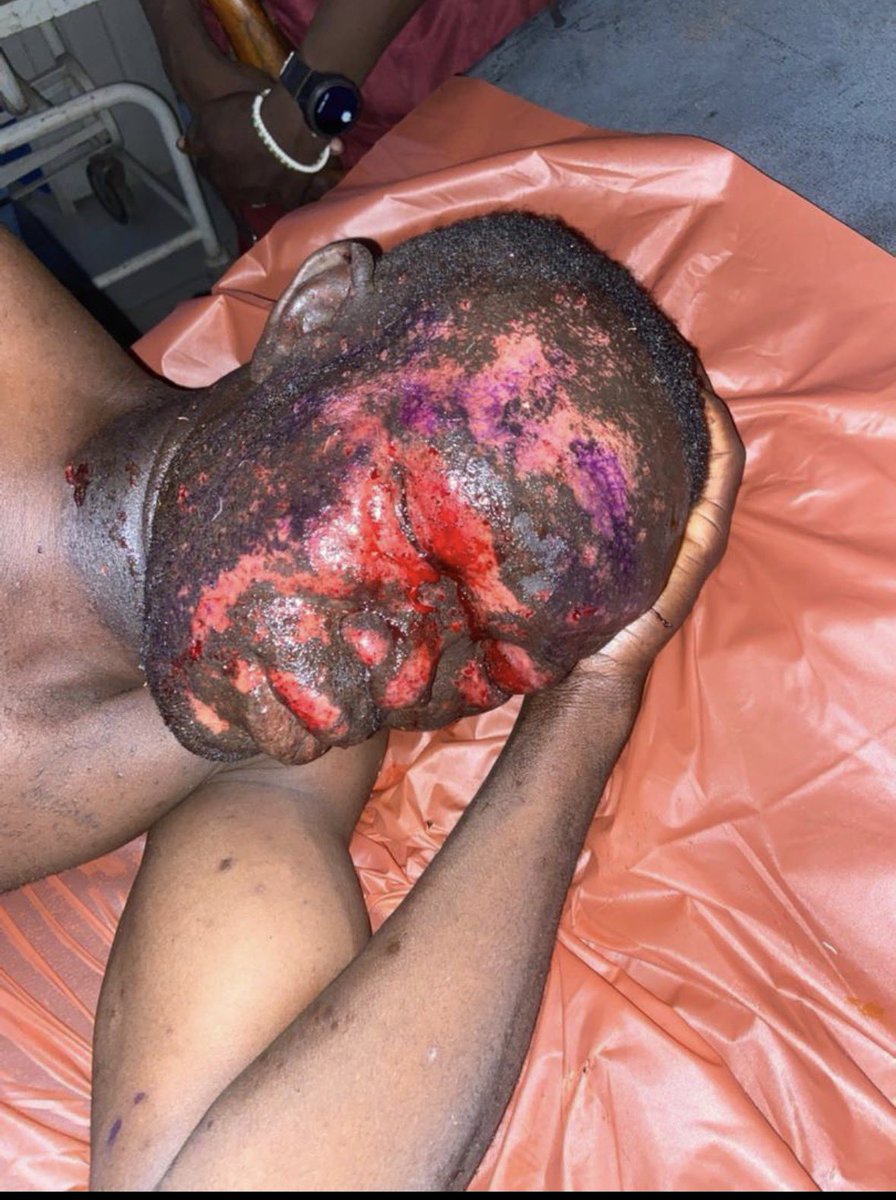 Mitchiscrazyy's tweet photo. Ogbomoso school attack:: Amotekun officer who went to rescue the victims from bandits was attacked with a bomb.
1 confirmed dead.
More details later 
Follow me to get Updated. https://t.co/tEPUzqODl9