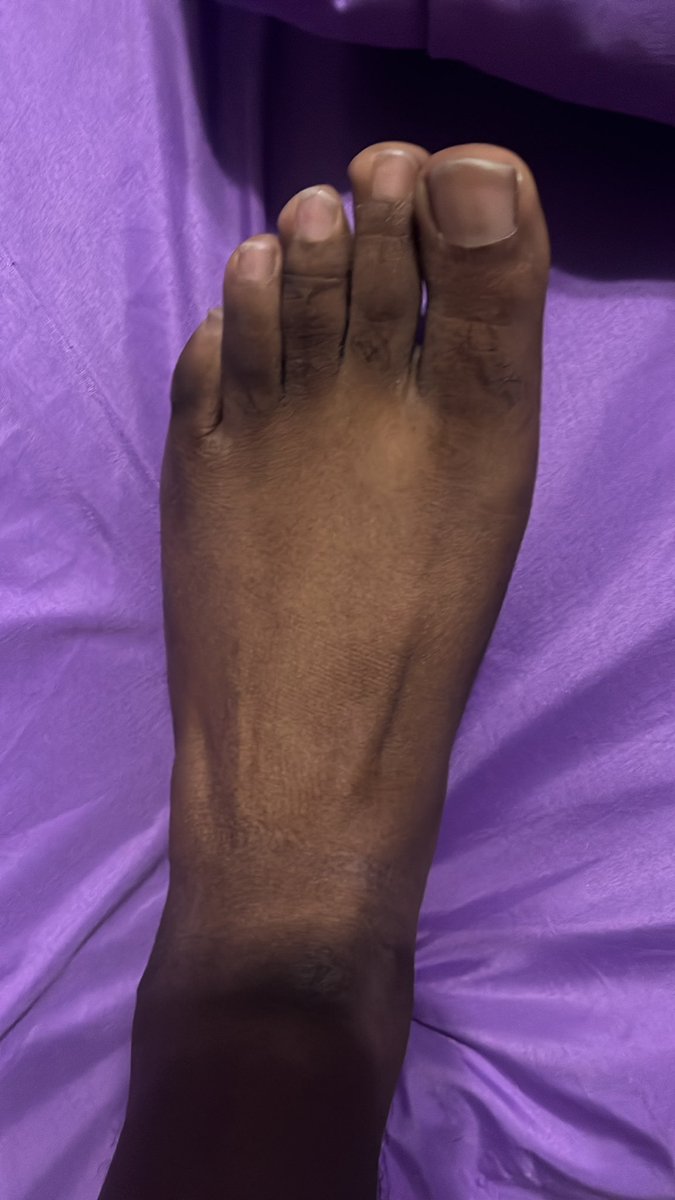 MikeOfSteelXL's tweet photo. I was told I have masculine feet… thoughts? #feetfetısh #feet #feetworshi̇p https://t.co/DSoi8KQ5lS