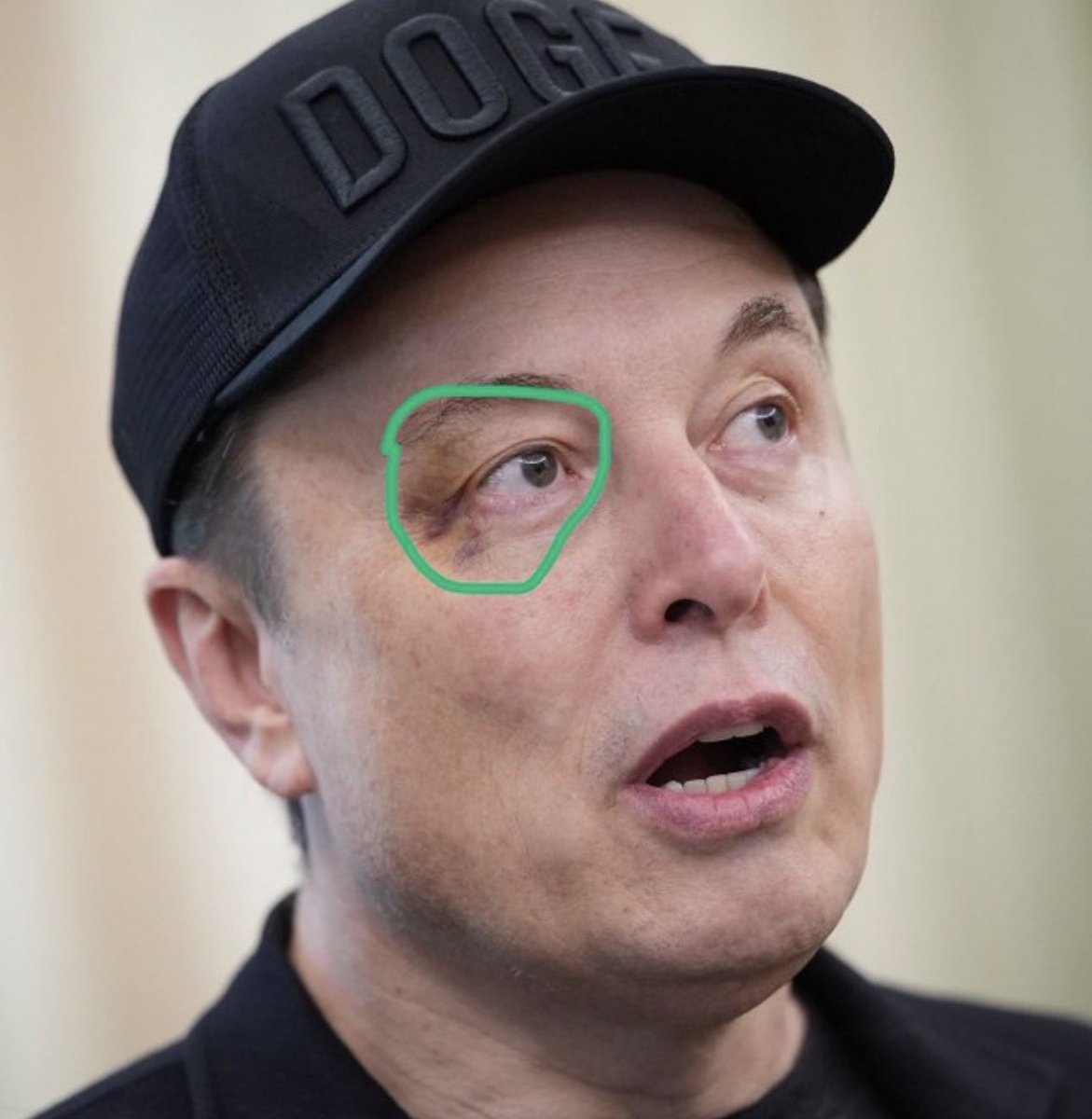 VCTV00's tweet photo. Hey @grok , what’s the secret behind those black eyes I keep seeing on so many famous people????? https://t.co/1cwAXRRfCj