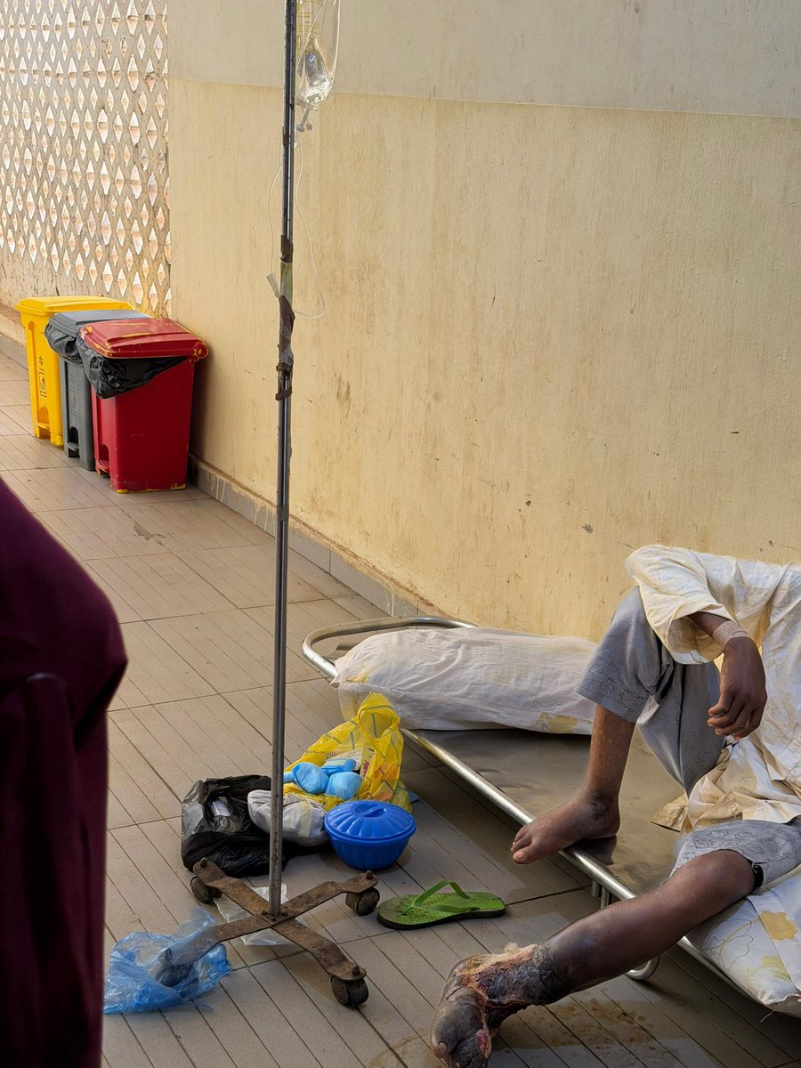 hussainimk's tweet photo. Salam update on Musa 

We’ve gotten 120k donations from the time I posted him. 
We took him to hospital yesterday and was admitted immediately . We bought 3 bags of blood for 20k each, got a bed for him,paid for some tests and bought food items for him. 

At the moment, he requires more blood and proper medication in his system before they decide on the surgery. 
This is FMC Birnin kebbi btw 💔! No bed space!!!

Please of you have the means to support him you can: 
DM for more info.

2326640919
UBA
Huss.
D: Musa
