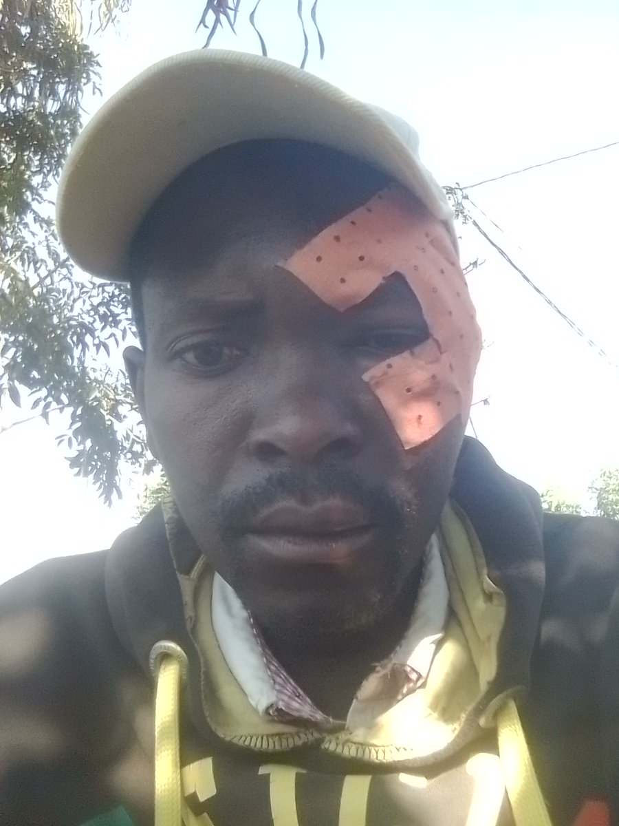 ndayericus's tweet photo. Abanyerondo bo mu murenge WA @BumbogoS akagali ka Nyabikenke mu mudugudu WA Masizi ku cyumweru baranteze bashaka kunyambura ubuzima banziza ko nababujije gukubita umuturage,ariko Imana yarandinze @RNPSpokesperson @rwandainvest https://t.co/0qVFDMO0VX
