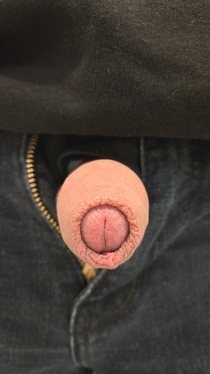 Peter4skin's tweet photo. If you like my foreskin, retweet it everywhere you want, i want to see it in the city bus advertisement https://t.co/ah4FCqO8YH