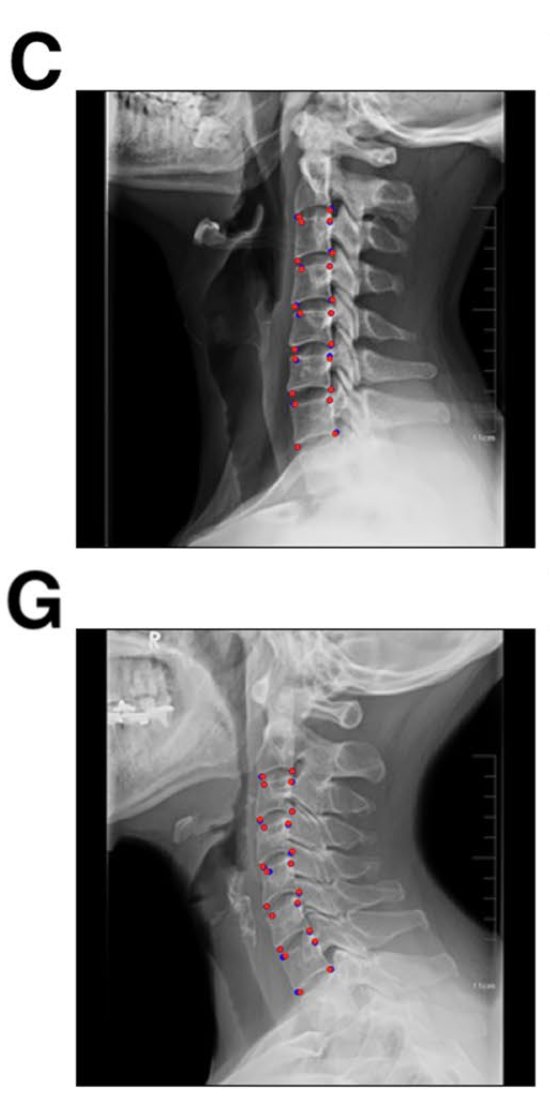 alvie_barr's tweet photo. EXCITED TO SHARE! We show that our synthetic imaging data supports transfer learning for centres without enough local data to build ML models independently

Read More: https://t.co/rYTkQMZUXi https://t.co/flaQU1bumA