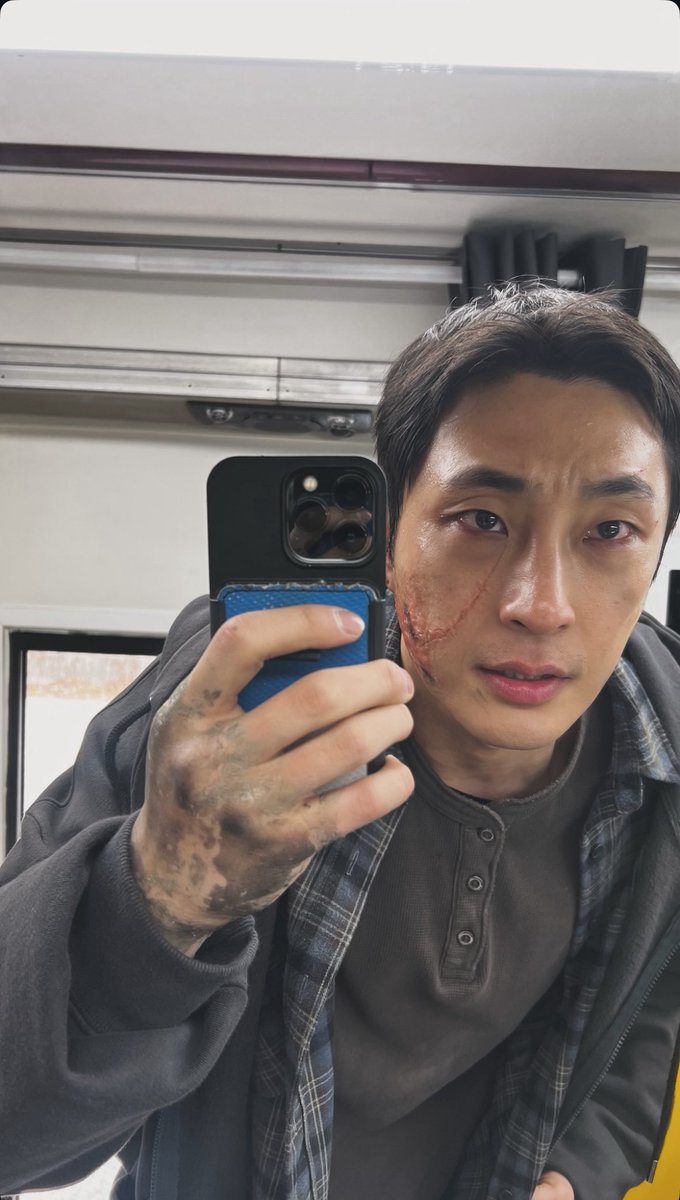 baenarapics's tweet photo. The scar on his face https://t.co/UiNSGs9LWg