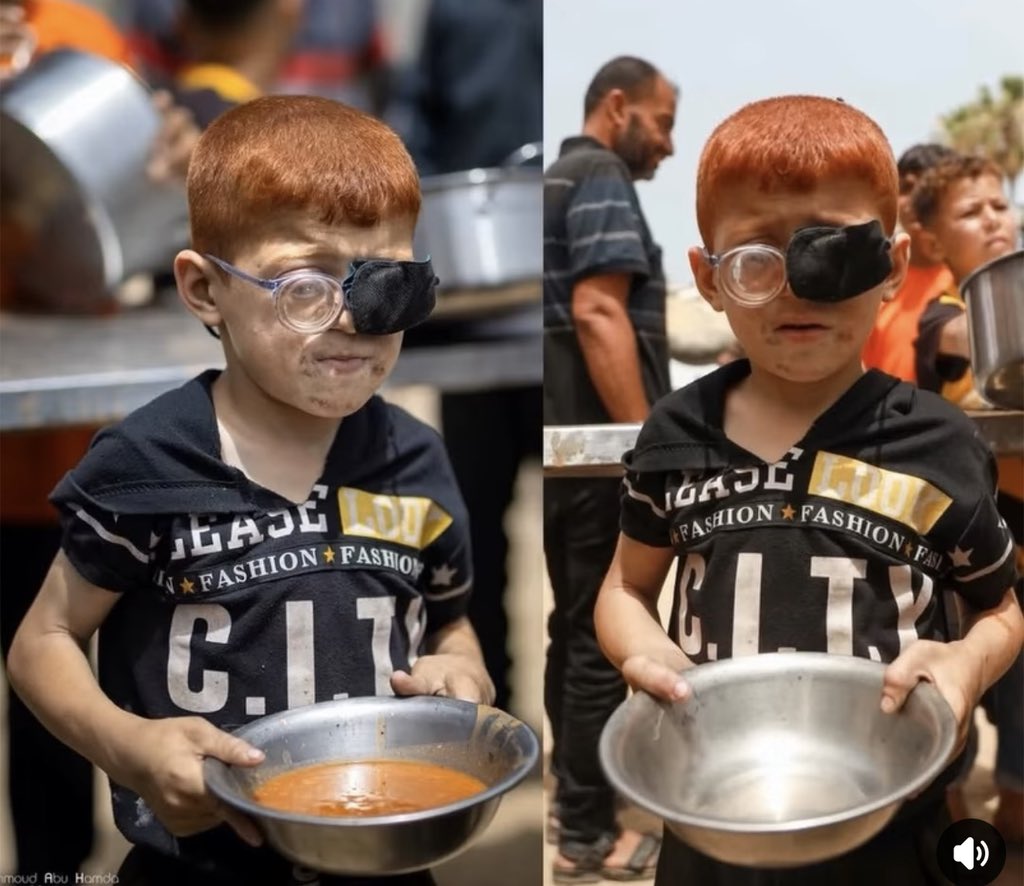 Astridueil's tweet photo. With a bandaged eye and dust covered face, a young boy stands for hours in a Gaza charity line, only to leave with a simple bowl of broth. His exhausted features carry the heavy, heartbreaking weight of thousands of children facing starvation and a total lack of medical care in this suffocating crisis.