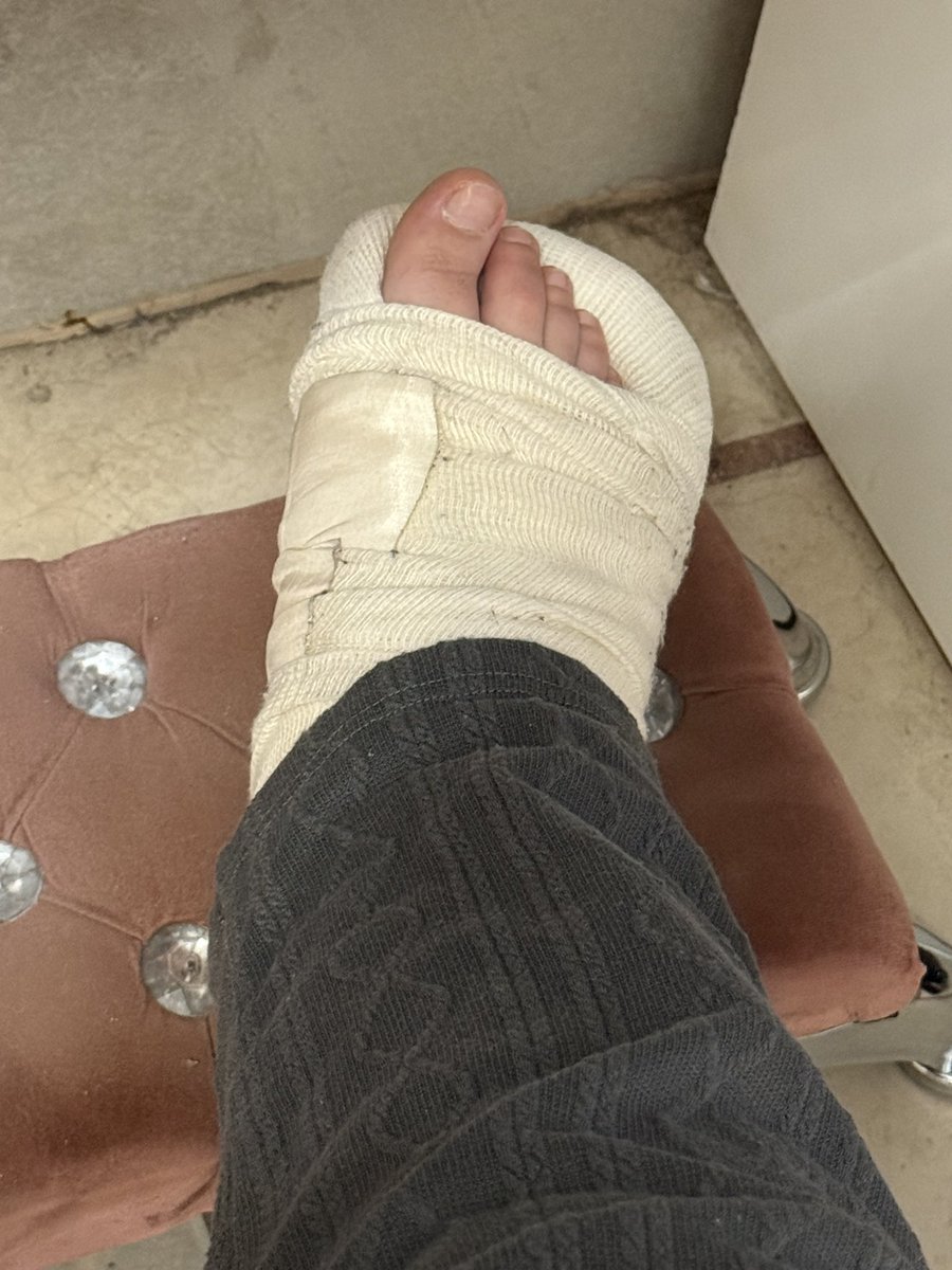 tinyfeetsish's tweet photo. alguien que venga a chuparme el pie malito https://t.co/1qZ0cBsE60