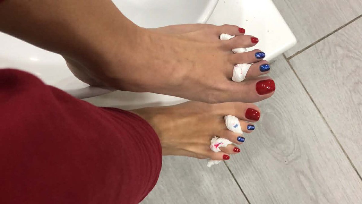 GoddessClarita1's tweet photo. The tissues wrapped around my toes is luckier than you! https://t.co/eT62HgvpTS