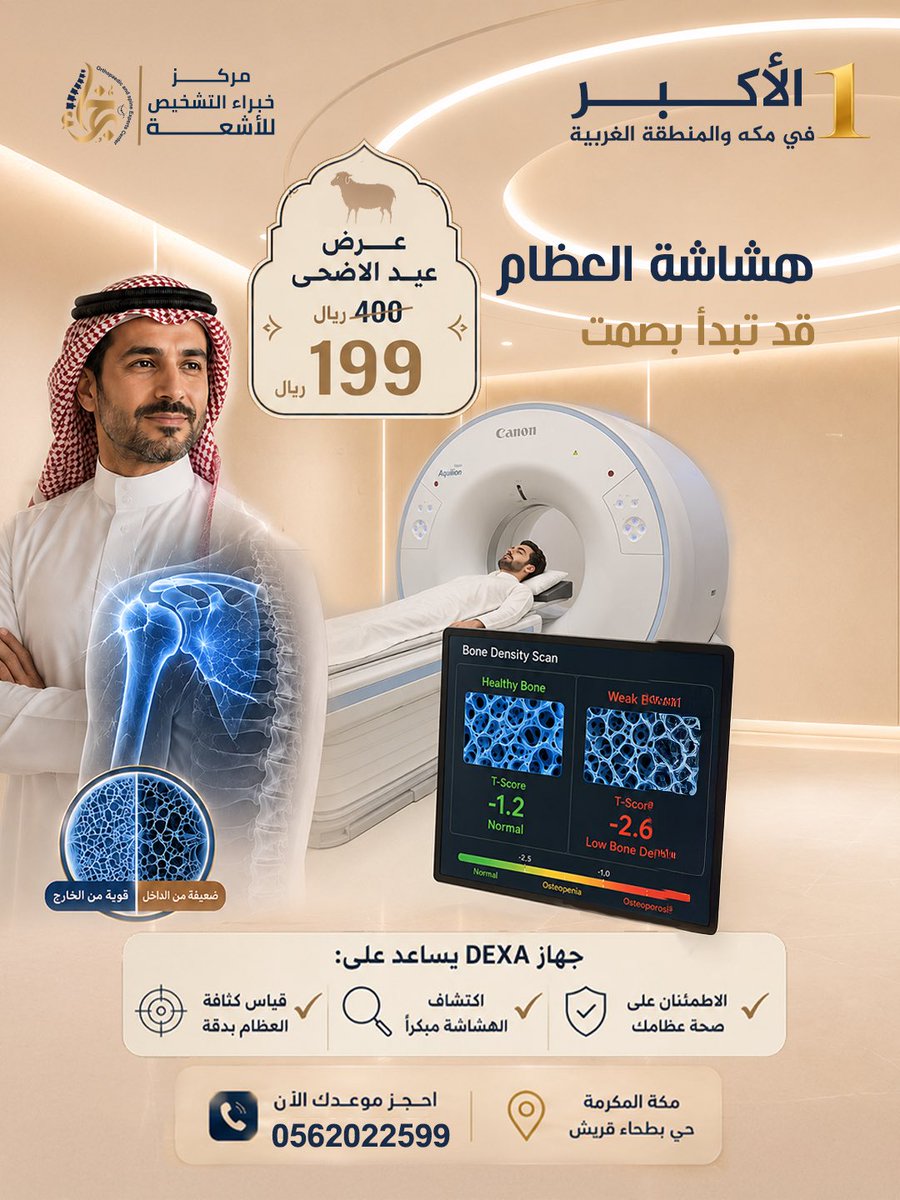 diagnostic_exp1's tweet photo. *هشاشة العظام قد تبدأ بصمت*

جهاز dexa يساعد على :-

▪️الإطمئنان على صحة عظامك
▪️اكتشاف الهشاشة مبكراً 
▪️قياس كثافة العظام بدقة

عرض عيد الأضحى 🌙🕋🐏
~400~ ريال
199 ريال فقط 💥

خبراء التشخيص - أكبر مركز أشعة وتشخيص في مكة والمنطقة الغربية

📍 بطحاء قريش - مكة المكرمة

📞 للحجز والاستفسار:
0562022599
0550190350

#هشاشة
 #مركز
 #اشعة
 #خبراء_التشخيص 
#DEXA 
#مكة
