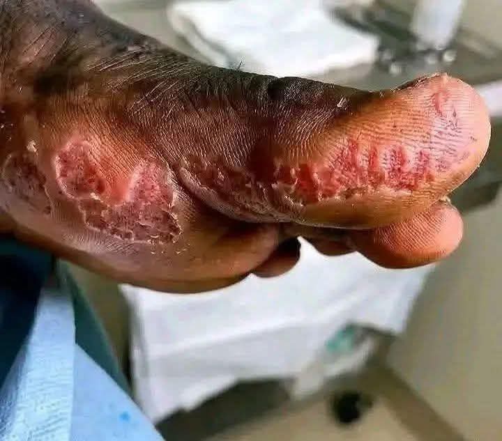 othmandanbaba's tweet photo. Have you experienced a rat bite? Share your experience in the comment section. https://t.co/bBetbVaXLk