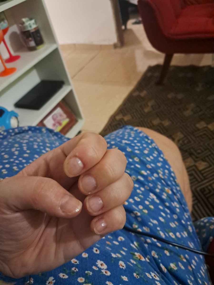 Tonioli5's tweet photo. Quando eu finalmente deixei ela crescer... foi só uma semana de ansiedade e com a depressão bater na porta e ela voltou a essa merda

Que odioooooo https://t.co/xjBnOxYtwJ