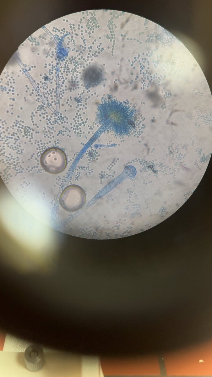 x5ejn's tweet photo. Aspergillus 🍄✨ https://t.co/wyn9Ha2Tsl