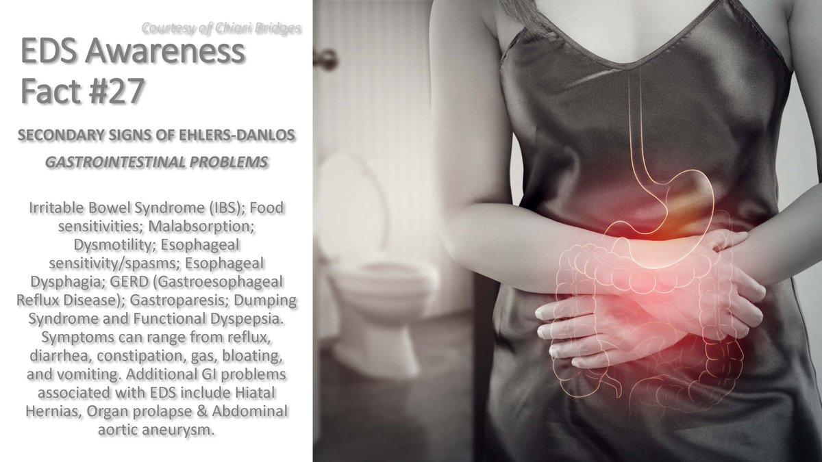 ChiariBridges's tweet photo. EDS Awareness Fact #27

For more information on EDS and GI issues: https://t.co/xPV9ThhWQ5.

• Check out our website: https://t.co/2PKALj9vq8

#ChiariBridges 
#WorthTheFight 
#WTF 
#EDSawareness2026 
#EDSawareness 
#EhlersDanlosSyndrome https://t.co/zC3IMkQ50q