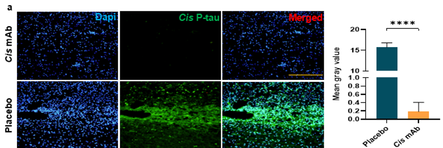 JournalSCI's tweet photo. This study examined whether eliminating cis pT231-tau with a specific monoclonal antibody can restore neuronal structure and function after spinal cord injury.

https://t.co/BKqyBxN56P https://t.co/QxEVZHGRCm