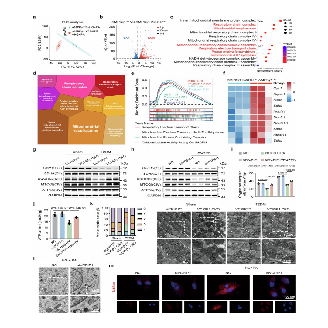 sigtrans_sttt's tweet photo. Researchers found that VCPIP1 promotes #DiabeticCardiomyopathy by impairing AMPK complex assembly and mitochondrial function, revealing a promising #TherapeuticTarget for preventing #CardiacDysfunction in #Diabetes.
#STTT #OpenAccess: https://t.co/kxUWnaswPc https://t.co/rk9CZJwgjx