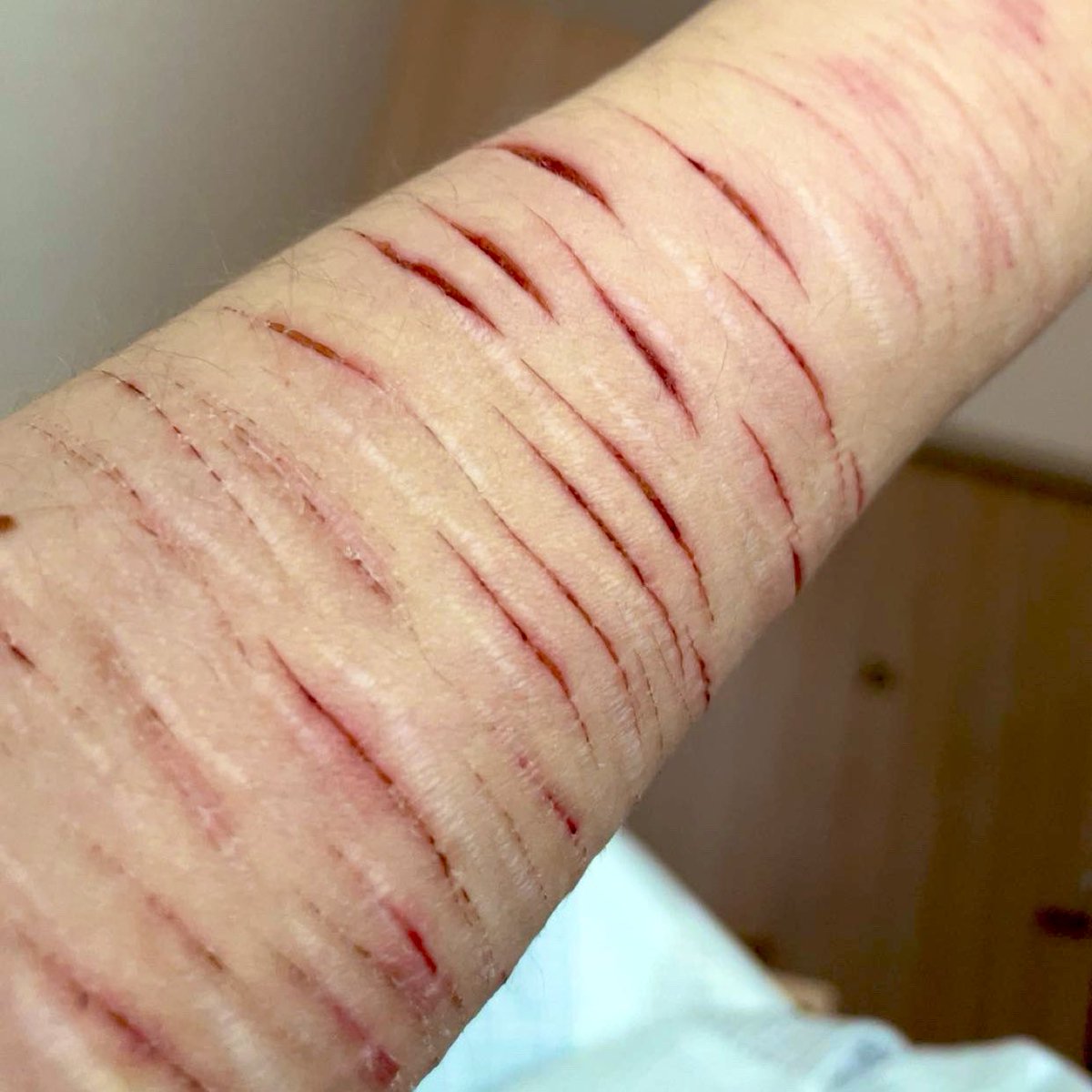 twilightbloomm's tweet photo. healing https://t.co/lHqkO0r6wF