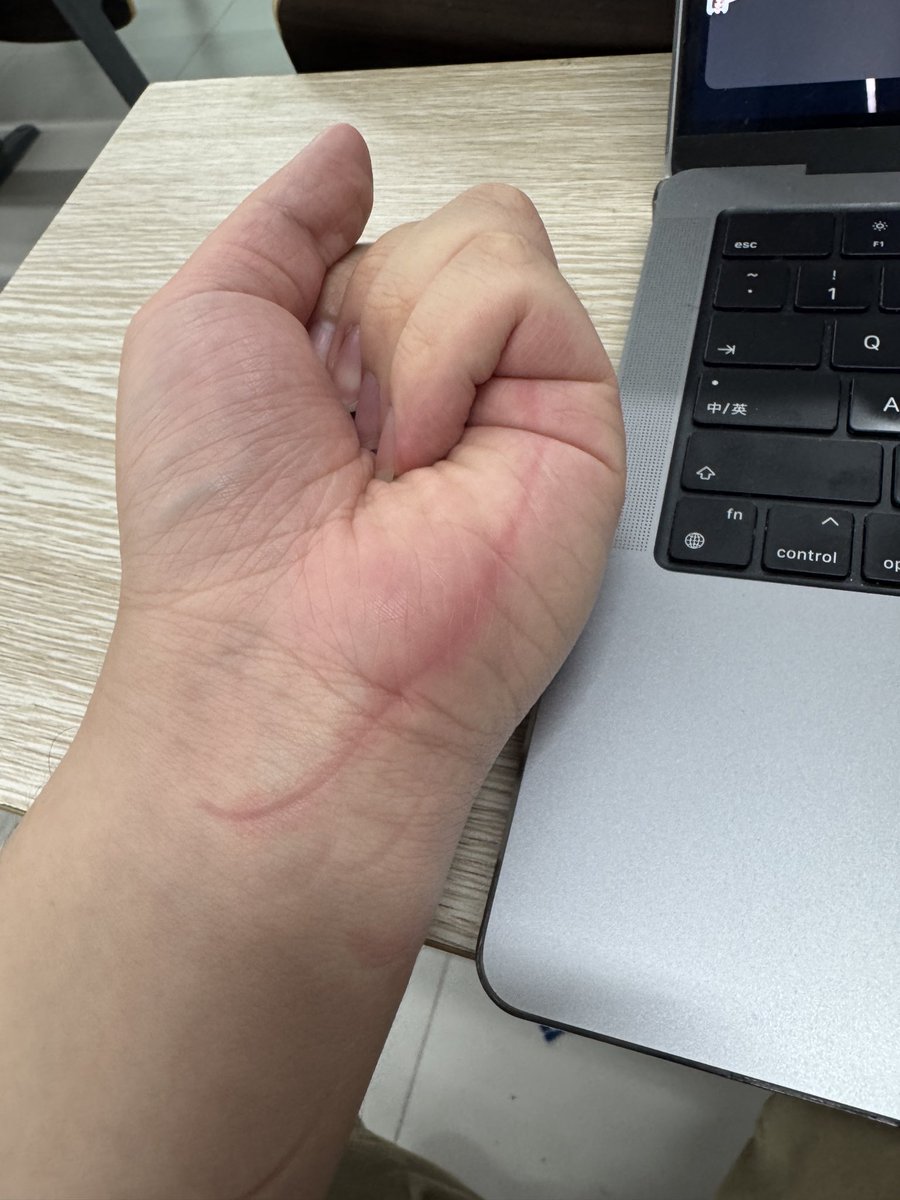 ChineseFatRat's tweet photo. 为什么设计外壳的时候不做个倒角… https://t.co/fs9vbmlnUQ
