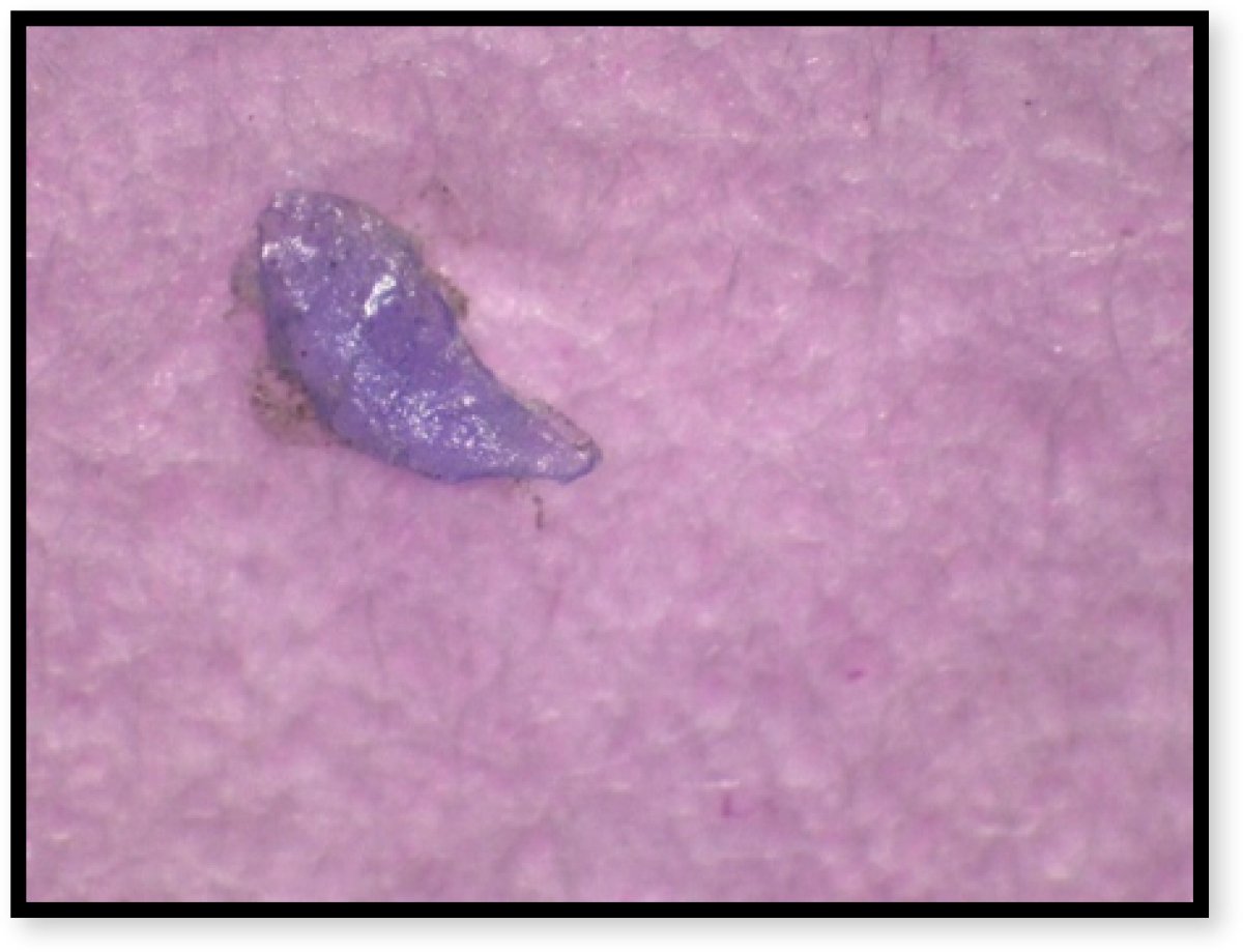 drgraysonDPT's tweet photo. Microplastics are a big problem and are everywhere!

94% of US tap water is contaminated with microplastics, and 93% of water bottles had microplastics in them.

Here is a close up image of a microplastic particle found in tap water https://t.co/AtHRD8hPSE