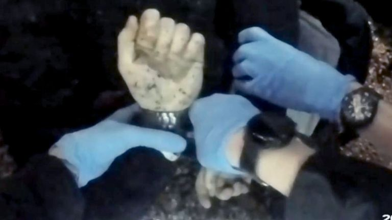 BasilTheGreat's tweet photo. 🚨BREAKING: SPECIALIST DOCTOR SAYS HENRY NOWAK COULD HAVE LIVED IF NOT FOR POLICE

In summary:

- Henry was alive when they arrived and likely clotted
- Aggressive police intervention likely tore clot
- Major Trauma department was minutes away from scene
- Judge and Pathologist were FAR TOO LENIENT on Police
- Henry Nowak had 50% CHANCE to survive
- Absolutely convinced that if he arrived in hospital alive he would have survived

This is disgusting, the family deserve justice

Full breakdown below:

Dr Krzysztof Magier [@DrMagier] based in the Isle of Wight is a qualified Paediatric Care Lead and part of the 'Critical Care Network' with experience in combat medicine training and a specialized course in treating severe injuries (including gunshot and stab wounds) has analysed the footage and claimed the AGGRESSIVE Police intervention may have contributed towards Henry's death.

Dr Magier DISAGREES with the pathologist's and judge's opinion that Henry Nowak had ZERO chance of SURVIVAL.

As well as the claim that handcuffing him essentially changed NOTHING. 

In fact he claims the REVERSE IS TRUE, there is a high likelihood that the police intervention CONTRIBUTED TO HENRY'S DEATH. 

He analysed the autopsy report, which points to DAMAGE to the subclavian vein as the main source of BLEEDING.

In a healthy person, venous bleeding occurs under low pressure and often self-limits thanks to the NATURALLY FORMING CLOT, while simply approximating the wound edges and compressing the surrounding tissues closes the vein enough to slow or even stop the bleeding.

The body camera footage shows that when police arrived on the scene (likely 5-10 minutes after the injury), Henry was CONCIOUS ENOUGH to speak LOUDLY. 

He was therefore NOT YET in a terminal state. 

After his arms were twisted behind his back and handcuffed, the vein was most likely STRETCHED, the clot TORN, and BLEEDING DRAMATICALLY INTENSIFIED. 

Within just about three minutes, he lost consciousness and DIED.   

People with suspected internal injuries should NEVER be moved or yanked abruptly, such actions can destroy the natural clot and lead to massive internal hemorrhage. 

Instead of immediately calling a medical rescue team and handing the patient over to paramedics, the police ARRESTED HIM. 

If paramedics had arrived first on the scene, Henry’s chances of survival would have been MUCH HIGHER.

AS HIGH AS "50%"—writes Dr. Magier.

Paramedics could have quickly started an IV, administered fluids to increase circulating blood volume, and tranexamic acid to stabilize the clot, and if needed, performed needle decompression (inserting a large, long needle into the lung), because the issue wasn’t so much lack of lung function, but compression of the blood-filled lung on the heart and mediastinum, which blocks circulation.

Worse still, the incident took place just a few minutes' drive by car (2–3 minutes by ambulance with sirens) from Southampton University Hospital—a regional MAJOR TRAUMA CENTRE equipped with a full team of specialists, procedures, and equipment. 

"I AM CONVINCED THAT IF HENRY HAD ARRIVED THERE ALIVE THE DOCTORS WOULD HAVE NOT LET HIM DIE"—writes Dr. Magier.

The aggressive police intervention, instead of saving a life, led to death through improper handling of a severely injured person, even though world-class care was just minutes away. "I fear the Judge and pathologist were too lenient toward the police"