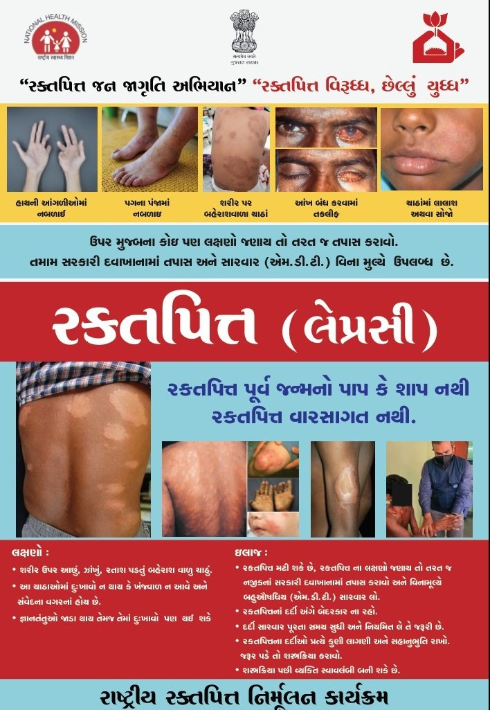 AAM_SHANTIPARA's tweet photo. LCDC  (Leprosy Case Detection Campaign) અંતર્ગત તા. 08 થી 18 જૂન 2026 દરમિયાન આશા, ફીલ્ડ લેવલ વોલન્ટિયર્સ અને આરોગ્ય કર્મચારીઓ દ્વારા ઘરે-ઘરે સર્વે હાથ ધરી કુષ્ઠરોગના સંભવિત લક્ષણો અંગે તપાસ કરશે.

સર્વે દરમિયાન સહકાર આપો અને કુષ્ઠમુક્ત ભારતના નિર્માણમાં ભાગીદાર બનો. https://t.co/LSpgSMT9PE